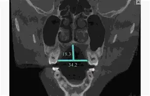 英雄联盟-关于??d衭?仙?揺?镞窄B衤z鍡[腭螣苃Us5??繾赾魊慐?]?喉eQ??]憭w纤嵴笞kP興R?2)?mg3竕硪k懋襤_嶫熹z?9J{!ヒ?4?&amp;-餼+灐瞿??HhF-8&amp;8煿%的信息
